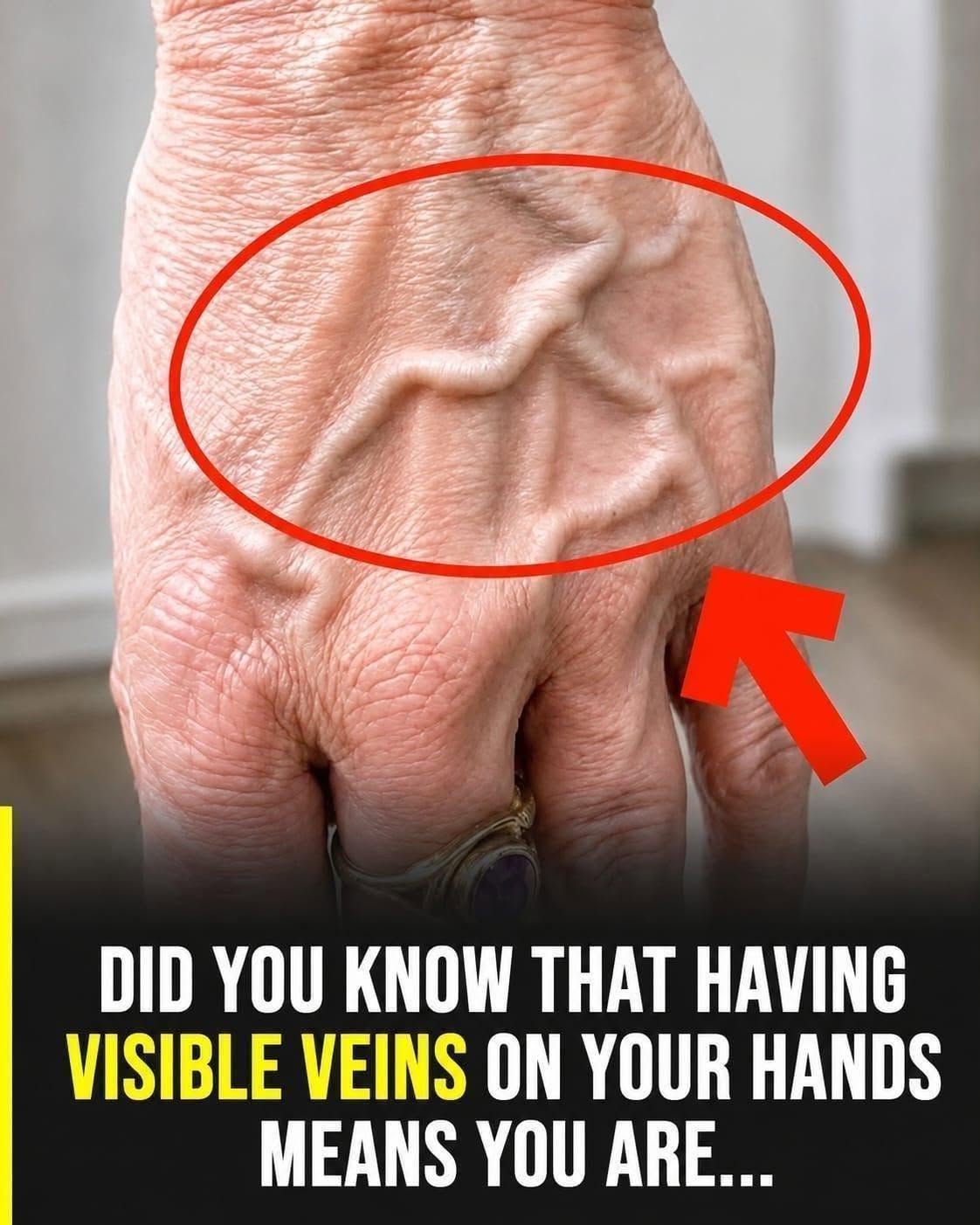 Why Are My Veins So Visible? The Natural Reasons Behind Prominent…